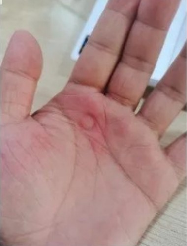 咳喘點位置