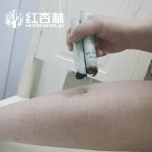 紅杏林中醫(yī)示范艾灸豐隆穴